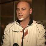 krstimir-pantic-napad